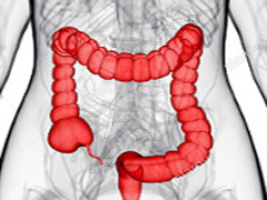 Székrekedés-domináns IBS-ben és krónikus székrekedésben segítenek a probiotikumok